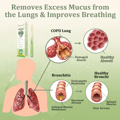 𝙊𝙛𝙛𝙞𝒄𝒊𝒂𝒍 𝑺𝒕𝒐𝒓𝒆✅𝐌𝐮𝐫𝐰𝒐𝒏® 𝐁𝐨𝐭𝐚𝐧𝐢𝐜𝐚𝐥 𝐌𝐮𝐥𝐥𝐞𝐢𝐧 𝐋𝐮𝐧𝐠 𝐂𝐥𝐞𝐚𝐧𝐬𝐞 𝐃𝐢𝐟𝐟𝐮𝐬𝐞𝐫🔥(👨‍⚕️Cough, Pharyngitis, shortness of breath, sputum, stuffy nose, bronchitis, bronchitis, allergy symptoms, lung discomfort)2❤️